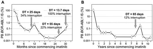 Figure 2. Molecular patterns associated with imatinib dose interruption. Consecutive days of zero dose, amounting to at least 10% of days of a BCR-ABL1 measurement interval, is likely to lead to a BCR-ABL1 increase. The dose interruptions in both examples were evident at the molecular level, but without an increase above 1% IS. The molecular equivalent of Philadelphia chromosome detection is above 1% IS. The BCR-ABL1 doubling time (DT) at the increase demonstrates an inverse relationship with the length of the dose interruption. The interruptions were the decision of each patient and were declared to their clinicians. Recommencing imatinib led to rapid reduction of BCR-ABL1.