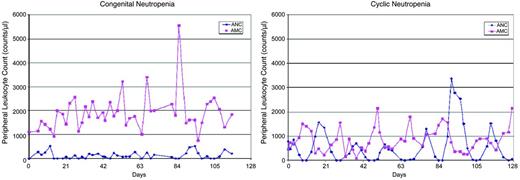 Figure 1. Pattern in a patient thought to have cyclic neutropenia compared with an individual with classic cyclic neutropenia. (Left) ANC and absolute monocyte count in a patient with congenital neutropenia over time. (Right) ANC and absolute monocyte count in a patient with cyclic neutropenia over time.