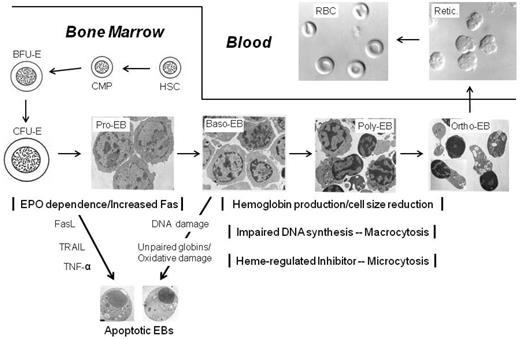 Figure 1. Erythropoietic stages and the development of chronic anemia. The erythropoietic stages in the BM begin with the HSCs, which proliferate and differentiate, giving rise to the common myeloid progenitors (CMPs) and burst-forming unit-erythroid (BFU-Es) before reaching the first stage of EPO dependence, the CFU-E. These progenitors are defined by their growth in culture, but their progeny, the proerythroblast (Pro-EB) through orthochromatic erythroblast (Ortho-EB) stages are recognized by their morphological appearance in stained smears of BM aspirates or ultrastructural studies of purified populations, as shown for mouse erythroblasts. The CFU-E and proerythroblasts express large amounts of the proapoptotic receptor Fas, which can be down-regulated by EPO. Fas mediates apoptosis induced by its binding of FasL on other erythroblasts and multiple myeloma cells. Other apoptosis inducers in the BM include TNF-α and TRAIL. After the Pro-EB stage, the basophilic (Baso-EB) and polychromatophilic (Poly-EB) stages are characterized by Hgb production and progressive deceases in cell size. The relative rates of cell division and protein synthesis during these 2 stages determine the size of the erythrocytes that are produced. Impaired DNA synthesis and DNA damage result in apoptosis of erythroblasts and macrocytic erythrocytes. Excess globin chains that are not assembled into Hgb, as in thalassemia or insufficient heme production from iron deficiency, cause oxidative damage that can lead to apoptosis, but their effects are mitigated by a heme-regulated inhibitor that decreases protein synthesis and leads to microcytosis. Enucleation at the Ortho-EB stage results in extruded nuclei (N) that are rapidly phagocytosed in the BM and reticulocytes (R) that egress into the BM venous sinusoids and circulate in the blood. The circulating reticulocytes (Retics.) mature over 1-2 days by shedding and degrading their internal organelles and assuming their biconcave discoid shape (RBCs). Electron micrograph images of erythroblast stages are modified from Koury et al41 and Kelley et al42; and differential interference contrast microscopy images of reticulocytes and RBCs are modified from Koury et al.43