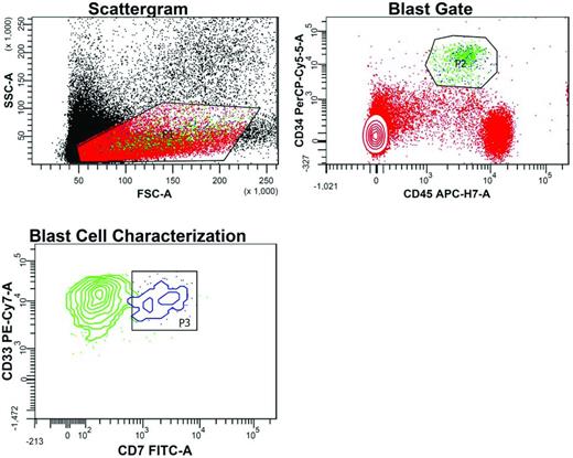 Figure 1. Flow cytometric detection of MRD after induction chemotherapy in the BM of an AML patient led by the patient's LAIP. In the Scattergram, a gate (P1) is set around cells with low forward scatter (FSC) and side scatter (SSC), reflecting small to intermediate size and low granularity, respectively. In the blast gate, cells (green dots) within P1 with high CD34 and intermediate CD45 expression are selected away (P2) from normal lymphocytes (red dots with high CD45 expression) and erythroid precursor cells (red dots lacking CD45). Gating based on the typically reduced intensity of staining with the pan-leukocyte marker CD45 facilitates the detection of leukemic cells. In the blast cell characterization contour plot, MRD is detected within the CD34HIGHCD45WEAK gate based on the dual expression of CD33 and CD7 (P3, blue cluster). These cells with the patient's LAIP features account for 0.013% of all nucleated cells, a common denominator for MRD definition. The remaining green cells in this plot represent normal myeloid precursor cells (CD33+CD7−) caught in P2.