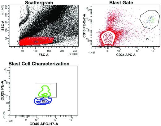 Figure 3. Flow cytometric detection of MRD after induction chemotherapy in the peripheral blood of an AML patient led by the patient's LAIP, which included CD25. In the scattergram, a gate (P1) is set around cells with low forward scatter (FSC) and side scatter (SSC), reflecting small to intermediate size and low granularity, respectively. In the blast gate, cells within P1 with high CD34 and high CD13 expression are selected away (P2) from CD34−CD13− cells (red dots), representing predominantly lymphocytes. Some CD34−CD13+ cells are monocytes caught in P1. In the blast cell characterization contour plot, MRD is detected within the CD34+CD13+ gate based on the expression of CD25 and intermediate CD45 staining (green cluster). These cells with the patient's LAIP features (CD34+CD13+CD45WEAKCD25+) account for 0.003% of all nucleated cells, a common denominator for MRD definition. The blue CD25− cluster represents normal myeloid precursor cells (CD34+CD13+CD45WEAKCD25−) caught in P2.