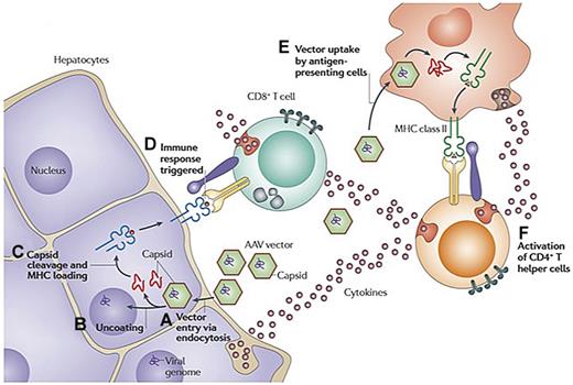 Figure 2. Hypothesis explaining simultaneous rise in liver enzymes and decline in FIX levels at high dose in AAV-FIX trials. (A) AAV enters the cell via receptor-mediated uptake into clathrin-coated endosomes. (B) On endosomal escape, AAV vector is released into the cytosol. Vector genomes are then released from the capsid in a process called uncoating. (C) At least some of the capsid undergoes ubiquitination and proteasomal processing. Capsid-derived peptides are transported to the endoplasmic reticulum and loaded onto MHC class I molecules. The peptide/MHC complexes are displayed on the surface of the transduced cell. (D) MHC class I presentation flags hepatocytes for recognition by capsid-specific CD8+ T cells, resulting in release of cytolytic granules and clearance of the transduced cells. (E) Vector is also taken up by antigen-presenting cells and presented via MHC class II, resulting in (F) activation of CD4+ T helper cells and production of cytokines. Adapted with permission from Figure 3 in Mingozzi and High.61
