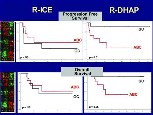 Figure 2. OS and PFS according to the treatment and GC/ABC classified by the gene predictor based on gene signatures.34 Gray lines indicate patients with a GCB profile (n = 19, 51%). Red lines indicate patients with an ABC profile (n = 18, 49%). Patients with GCB-like DLBCL treated with R-DHAP had a significantly better PFS and OS than patients with ABC-like DLBCL treated with R-DHAP. Patients treated with R-ICE had poor survival regardless of the molecular subtype. Adapted by Catherine Thieblemont from Thieblemont et al.15