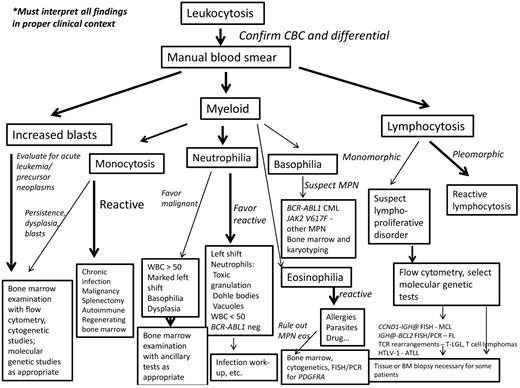 Figure 4. Diagnostic algorithm for the workup of leukocytosis. If increased blasts are present, then evaluation for an acute leukemia or precursor neoplasm should begin with BM examination including appropriate ancillary studies. If myeloid cells are present, the leukocytosis should be stratified into neutrophilia, monocytosis, basophilia, or eosinophilia; more than one type of leukocytosis may be present. Most monocytoses are reactive in nature. However, if reactive causes have been excluded, a persistent monocytosis of more than 3 months or the findings of dysplasia, blast cells, or significant left shift should trigger a BM examination to evaluate for malignancy. Neutrophilia should prompt examination for left shift, signs of activated neutrophils, basophilia, dysplasia, and degree of leukocytosis. Most neutrophilias are reactive in nature. A WBC count < 50 × 109/L, but usually < 30 × 109/L, is typical. Signs of activated neutrophils, mild left shift, and an absence of basophilia all suggest a reactive process. A marked leukocytosis of > 50 × 109/L, marked left shift, dysplasia, or basophilia should prompt a BM examination to evaluate for a myeloid malignancy. Basophilia, although rare, is most suggestive of a MPN, especially CML. PCR for BCR-ABL1 and JAK2 mutational studies can be performed in blood, but a BM examination with cytogenetic studies should also be performed. Most eosinophilias are reactive in nature and these should be evaluated as outlined by Gotlib.30 Once reactive eosinophilias are excluded, myeloid and lymphoid neoplasms with eosinophilia and PDGFRA, PDGFRB, and FGFR1 should be searched for by performing a BM examination, cytogenetic studies, and FISH or PCR for the PDGFRA mutation. If a lymphocytosis is present, the lymphoid cells should be examined for pleomorphism or monomorphism. A pleomorphic lymphocytosis favors a reactive lymphocytosis. Correlation with clinical findings is necessary; a monospot test for EBV or viral serologies can also be performed. If monomorphic lymphocytosis is present, a lymphoproliferative disorder should be searched for using flow cytometric immunophenotyping. Depending on these results, select molecular genetic tests will be helpful. A BM biopsy or extramedullary tissue biopsy may be necessary for a final diagnosis of lymphoma. CBC indicates complete blood cell count; MPN, myeloproliferative neoplasm; MPN eos, myeloid and lymphoid neoplasms with eosinophilia and abnormalities of PDGFRA, PDGFRB, or FGFR1; and FL, follicular lymphoma.
