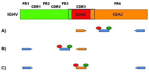 Figure 2. PCR approaches for MRD detection. Top row is a schematic representation of the variable domain of the IGH chain derived from the rearrangement of an IGHV (green), an IGHD (red), and an IGHJ (orange) gene. Dotted areas represent complementarity determining regions (CDR1-3). Full areas represent framework regions (FR1-4). One to 3 different approaches for allele-specific oligonucleotide RQ-PCR are represented (see text for details). Consensus primers and probes are depicted in blue. CDR3-specific primers and probes are depicted in orange.