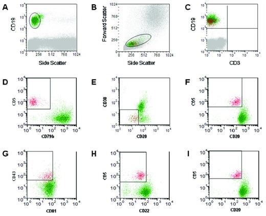 Figure 3. MRD analysis using 6-color flow cytometry assay. A representative analysis of a peripheral blood sample is shown, in which the presence of an obvious MRD population can be seen. Analysis was performed after gating cells based on the expression of CD19 (A) and the side/forward scatter profile (B) in both test tubes (see text). Leukemic cells are shown in red in panels C-H. For the first test tube, the CD19/CD3 combination (C) is used to calculate the number of CD3+ events in the B-cell gate and the combination of 3 gates based on CD5, CD20, CD79b, and CD38 expression (D-F) is used for the calculation of events with a CLL-like phenotype. For the second test tube, MRD events are identified through 3 gates based on the expression of CD5, CD20, CD22, CD43, and CD81 (G-I).