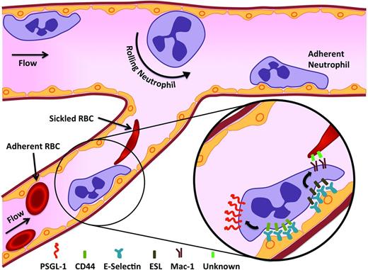 Figure 1. Sickle cell VOC. SS-RBCs and other inflammatory mediators induce the activation of the endothelium. The damaged and stimulated endothelium is poised to recruit leukocytes. E-selectin on the endothelium is crucial for generating a secondary wave of activating signals, which produces a polarized expression of activated αMβ2 integrin (Mac-1) at the leading edge of the crawling neutrophil, allowing the capture of circulating discoid and sickle-shaped erythrocytes. These events culminate in VOC in the postcapillary venules.