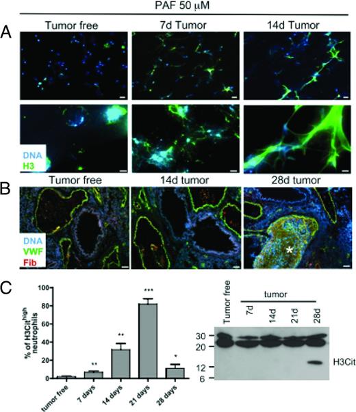 Figure 1. Evidence of in vivo NET formation in a murine cancer model. (A) The injection of tumor cells in mice increases the immunofluorescence of NETosis biomarkers DNA (blue) and citrullinated Histone 3 (H3) in murine neutrophils after stimulation with PAF; neutrophils from tumor-free mice show only minimal immunofluorescence for DNA and H3, whereas immunofluorescence increases after injection of the tumor (days 7 and 14). Scale bars indicate 20 μm in the top row and 5 μm in the bottom row. VWF- (V) and fibrin-rich thrombi form spontaneously in the lungs of tumor-bearing mice 28 days after tumor injection (n = 4); lung sections are immunostained for DNA (blue), VWF (green), and fibrinogen/fibrin (red). Scale bar indicates 50 μm. White star indicates a VWF- and fibrin-rich thrombus in the pulmonary vasculature. (C) Left, Tumor injection in mice increases the percentage of NET-generating neutrophils (as indicated by H3 hypercitrullination; plotted on the y-axis) from initially ∼1% in tumor-free mice to >80% at day 21 after tumor injection; the steep decline in the percentage of NET-generating neutrophils after day 21 was associated with spontaneous intravascular thrombus formation and may indicate a consumption of NETing neutrophils at the site of thrombosis. Right, Western blot analysis reveals the presence of H3 in the plasma of tumor-bearing mice 28 days after tumor injection. (Figure adapted with permission from Demers et al.13)