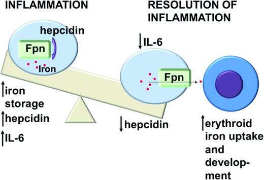 Figure 1. Inflammation stimulates increased production of the iron-regulatory peptide hepcidin by hepatocytes. Hepcidin binds the iron exporter ferroportin (Fpn), causing internalization and degradation of both proteins and decreasing delivery of iron from macrophages to developing erythrocytes. This impairs erythroid development and leads to anemia.