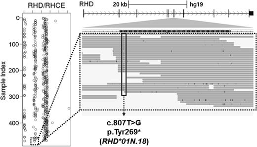 Figure 5. Example of NGS call in RHD. (Left) Whole gene RHD deletions are identified by relative read depth. Homozygotes for RHD deletions have values near the axis (0), hemizygotes exhibit 50% read depth, and individuals with 2 RHD copies have normal read depth. The dashed box indicates a serologic D-negative donor with one copy of RHD. (Right) Integrated genomics viewer (IGV) screen shot of an RHD variant, c.807T>G, identified in the D-negative donor (dashed box). This variant encodes a gain of STOP that has been reported previously (RHD*01N.18). Thus, this individual has one copy of RHD that harbors a known RHD nonsense mutation, explaining the observed D-negative serologic phenotype.