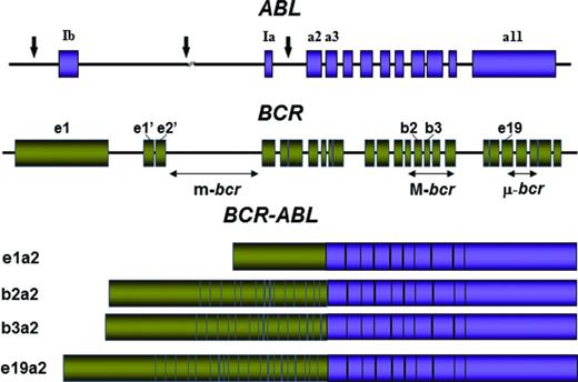 Figure 1. Location of the breakpoints in the ABL and BCR genes and structure of the chimeric mRNAs derived from the various breaks. Adapted from Deininger et al.41