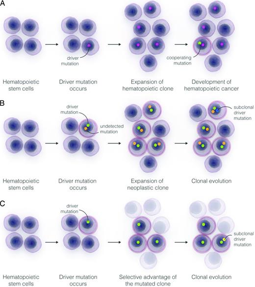 Figure 4. Models for the expansion of hematopoietic clones and the progression of into a hematologic cancer. (A) Expansion of a hematopoietic stem cell into a clonal population under the influence of a driver somatic mutation conferring a growth advantage to the cell, and potential progression into a myeloid neoplasm through the acquisition of subsequent subclonal driver mutations. (B) Expansion of a hematopoietic malignant clone under the influence of a driver mutation inferred from sequencing analysis and an undetected or as-yet-unknown cooperating mutation. In this scenario, the expected time to progression of the malignant clone to a clinical stage would be significantly shorter than under condition outlined in panel A. (C) Selection of a hematopoietic stem cell carrying a somatic mutation under the pressure of bone marrow environmental changes. The mutated clone is more fit to survive in an abnormal microenvironment than normal stem cells, and may expand sustaining a clonal hematopoiesis and eventually progress through the acquisition of subsequent subclonal driver mutations.