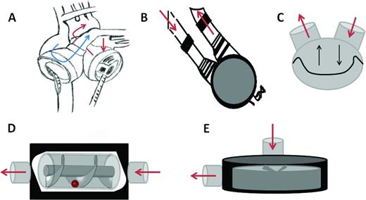 Figure 1. Schematic representation of mechanical circulatory support devices. (A) Total artificial heart. Blue arrow represents the path of deoxygenated blood and red arrows represent the path of oxygenated blood. (B) Pulsatile LVAD. (C) Oscillating membrane of pulsatile devices. (D) Continuous flow of axial LVAD. (E) Continuous flow of centrifugal LVAD.