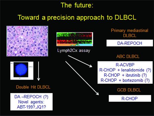 Figure 3. A precision approach to DLBCL. Double-hit status should be assessed on all patients and treated accordingly on a clinical trial or using the DA R-EPOCH platform. Assessment of cell of origin, using either immunohistochemistry, gene expression profiling, or in the future the Lymph2Cx assay then should allow patients to be separated into ABC and GCB subtype; there are several phase 3 trials evaluating unique approaches to the former. R-CHOP is adequate therapy for the GCB subtype, which is not double-hit. Primary mediastinal DLBCL is a unique clinicopathologic entity with specific treatment recommendations.