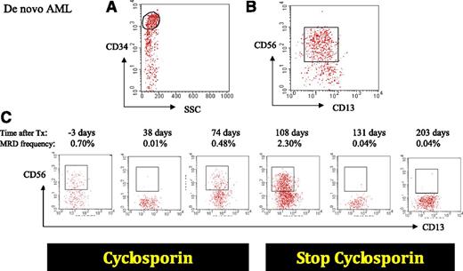 Figure 2. Sequential MRD monitoring in an allogeneically transplanted patient. De novo AML patient is characterized by a CD34+ population (A) with an aberrant expression of CD56 (B). Three days before transplantation, the percentage of MRD is high (0.7%) which is known to be highly predictive for a fast relapse; 38 days after allogeneic transplantation, the percentage of MRD has dropped down to 0.01%, but unfortunately rises to 2.3% at day 108 after transplantation. Stopping immune suppression at that time point led to a quick decrease of MRD in the next months (0.04% at days 131 and 203), probably due to the graft-versus-leukemia effect resulting from discontinuation of immune suppression.