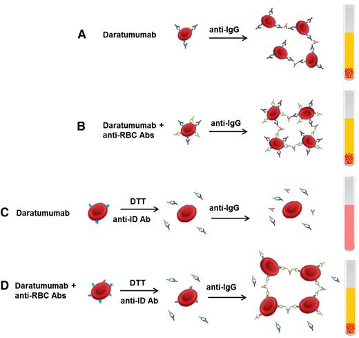 Figure 2. Interference with blood compatibility testing with DARA. (A) DARA binds to CD38 expressed on RBCs, leading to agglutination on indirect Coombs testing even in the absence of allo- or autoantibodies against RBC antigens. (B) In the presence of DARA and RBC antibodies, agglutination occurs. (C) Incubating reagent RBCs with DTT before adding patient serum will denature CD38 on RBC cells and prevent agglutination. Alternatively, the patient’s serum can be incubated with an anti-ID that neutralizes DARA and prevents its interaction with CD38. Either technique allows for the discrimination of clinically relevant RBC antibodies during pretransfusion antibody screening (D). Abs, antibodies; anti-ID, anti-idiotype Ab. Adapted from van de Donk et al32 with permission.