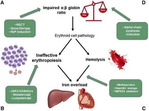 Figure 1. New therapeutic targets in β-thalassemias: (A,D) impaired α:β-globin ratio, (B) ineffective erythropoiesis, and (C) iron metabolism and hemolysis. TMPRSS6, transmembrane protease serine 6.