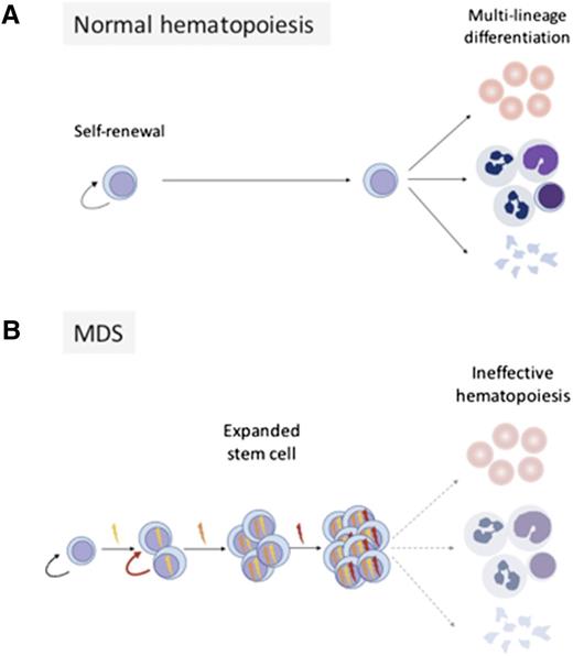 Figure 1. MDS gene mutations corrupt normal hematopoiesis. Panel A shows normal hematopoiesis, where HSCs possess the capacity for self-renewal and multilineage differentation. Panel B shows that serial acquisition of somatic mutations causes clonal stem cell expansion and impaired differentation.