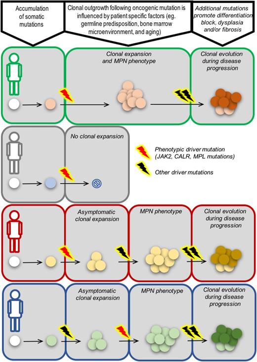 Figure 3. From origins to outcomes. Different evolutionary paths to MPN and disease progression in 4 patients, each with a unique genetic background (green, gray, red, blue). In the first patient (green), a phenotypic driver mutation acquired in an HSC results in clonal expansion and the emergence of an MPN phenotype as a consequence of favorable cell-intrinsic and/or environmental factors. The MPN in this context has no additional oncogenic driver mutations, as is common for patients in chronic phase. Additional driver mutations, such as those that perturb polycomb repressor 2 function (EZH2, ASXL1 mutations), spliceosome components (SRSF2, SF3B1, U2AF1), or DNA damage repair (TP53), can lead to cells gaining a further clonal advantage and disease progression. In the second patient (gray), the cell-intrinsic and/or environmental context is not favorable, and a cell acquiring a phenotypic driver mutation does not have a clonal advantage relative to competing normal cells. In some circumstances, a phenotypic driver mutation may be insufficient to result in abnormal blood counts and an overt MPN but can instead result in a clonal expansion. Additional mutations or cell-extrinsic changes may be required to result in emergence of disease (patient in red). Finally, in some patients, phenotypic driver mutations may not be the first event. Clonal hematopoiesis as a result of mutations in, for example, TET2, DNMT3A, ASXL1 may be the required backdrop for a phenotypic driver mutation to result in an overt MPN (patient in blue).