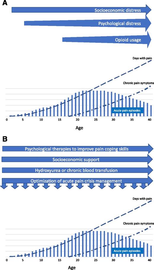 Figure 2. Evolution of acute pain and chronic complications of pain in a severely affected patient. (A) Timeline of non–disease factors impacting the pain experience. (B) Timeline of proposed interventions for modifying the pain experience. There is no numerical scale on the y-axis, and quantitative comparisons of pain episodes, days with pain, and chronic pain symptoms are not intended.