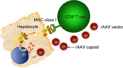 Figure 1. Hypothesis of the cellular immune response to hepatocytes after rAAV transduction. rAAV enters the hepatocyte by receptor-mediated endocytosis, wherein the vector genome, including the transgene, is released from the capsid (uncoating). Thereafter, the capsid is degraded in the cytosol, and capsid peptides are loaded onto major histocompatibility complex (MHC) class I on the surface of the transduced hepatocytes. Presentation of capsid peptides on MHC class I triggers a cellular immune response to the transduced hepatocytes, resulting in clearance of the hepatocyte.