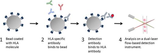 Figure 1. Luminex HLA antibody assay principle. The principle of the Luminex-based HLA antibody assay is depicted. (1) Bead coated with HLA molecules. Up to 100 different sets of color-coded beads, each bearing 1 or several HLA types can be tested simultaneously. Each bead set is internally dyed with differing ratios of 2 fluorochromes resulting in a unique signal. (2) After incubation with the test serum, the HLA antibody, if present, binds to the appropriate HLA molecule. Non-HLA antibodies are discarded after washing. (3) The bound HLA antibody is detected by a phycoerythrin-conjugated secondary antibody specific for human IgG. (4) The beads are analyzed on a dual-laser flow-based detection instrument. The red laser classifies the bead and determines the HLA molecule that is being detected. The green laser determines the magnitude of the phycoerythrin-derived signal, which is proportional to the amount of HLA antibody bound.