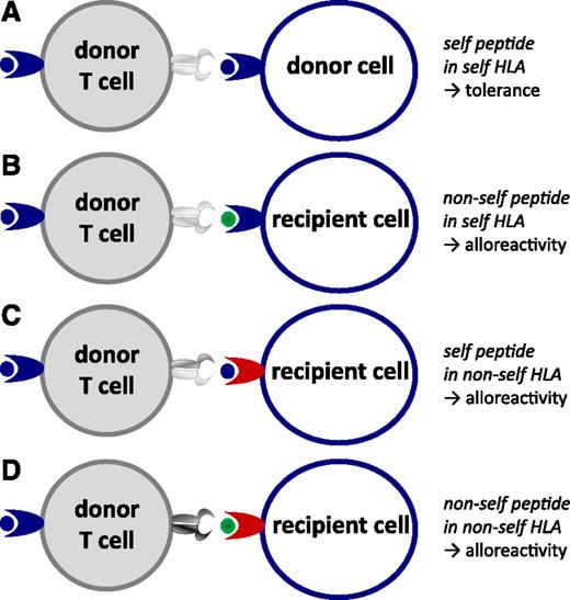 Figure 1. Peptide/HLA complexes as targets of T cell–mediated alloimmune reactivity. (A) Self peptides expressed in self HLA molecules induce tolerance. (B) Polymorphic nonself peptides recognized in the context of self HLA molecules can induce alloreactivity; these polymorphic nonself peptides are called minor histocompatibility antigens (MiHA). (C) Monomorphic (self) peptides presented in the context of nonself HLA molecules provoke alloreactivity. (D) Polymorphic nonself peptides in the context of nonself HLA molecules can also provoke alloreactivity.