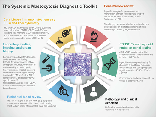 Figure 1. The SM diagnostic toolkit. Establishing a diagnosis of SM and staging the extent of disease require integrated clinical, histopathologic, laboratory, radiology, and molecular/cytogenetic testing. Referral to specialized centers with expertise in mastocytosis is recommended given the rarity of these diseases, particularly advSM variants. AHN, associated hematologic neoplasm; ASO-qPCR, allele-specific oligonucleotide quantitative polymerase chain reaction; CT, computed tomography; DEXA, dual-energy x-ray absorptiometry; GI, gastrointestinal; MRI, magnetic resonance imaging.