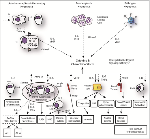 Figure 2. Updated model of iMCD pathogenesis. Three hypothesized mechanisms may be responsible for the iMCD cytokine and chemokine storm: first, the autoimmune/autoinflammatory hypothesis involves (1a) auto-antibodies triggering proinflammatory cytokine release by antigen-presenting cells that induce the as-yet-unknown hypercytokine-secreting cell to release IL-6 or other pathologic cytokines; (1b/c) dysregulated signaling in an antigen presenting cell or other as-yet-unknown hypercytokine-secreting cell releasing IL-6 or other pathologic cytokines, or (1d) a defect in the regulation of activated inflammatory cells. The cytokine and chemokine storm is perpetuated by positive feedback of IL-6, other pathologic cytokines, and/or possibly further auto-antibody stimulation. Second, the paraneoplastic syndrome hypothesis involves a somatic mutation in benign or malignant cells inside or outside of the lymph node that causes constitutive cytokine release. Preliminary data suggest these may be lymph node stromal cells. Third, the pathogen hypothesis involves either infection with HHV-8 that is clinically undetectable, a novel virus, or another pathogen signaling proinflammatory cytokines. An active infection by a single virus is less likely based on preliminary data generated from pathogen discovery studies. Regardless of the etiology, the cytokine and chemokine storm is the common pathway that results in the subsequent clinical and histopathological features of iMCD. AAB, autoantibodies; AIHA, autoimmune hemolytic anemia; AIT, autoimmune thrombocytopenia; LAD, lymphadenopathy; PMN, polymorphic neutrophil. Adapted from Fajgenbaum et al.1