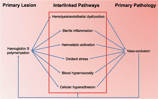 Figure 1. Simplified schematic of the primary pathogenic processes in SCD. SCD is caused by the inheritance of a mutated β-globin chain of hemoglobin (HbS). Polymerization of HbS in RBCs is the primary, fundamental lesion of SCD and leads to the pathognomonic sickle, crescent-like deformation of RBCs. Sickling of RBCs in turn leads to rheological, inflammatory, and cellular pathology via multiple interlinked pathways that affect every compartment of the vasculature. Hemolysis and endothelial dysfunction, sterile inflammation, hemostatic activation, oxidant stress, blood hyperviscosity, and cellular hyperadhesion have all been described as necessary components of vaso-occlusion, the primary pathology of SCD. All pathways are closely interlinked. For instance, sterile inflammation is the major determinant of cellular hyperadhesion, and hemolysis is responsible in large part for hemostatic activation and oxidant stress. Each pathway may be the predominant mechanism of vaso-occlusion in certain vascular beds or in response to specific triggers, and all pathways, as well as HbS polymerization, are further stimulated and enhanced by vaso-occlusion in a vicious cycle. For instance, vaso-occlusion leads to ischemia-reperfusion injury, a major determinant of oxidant stress.