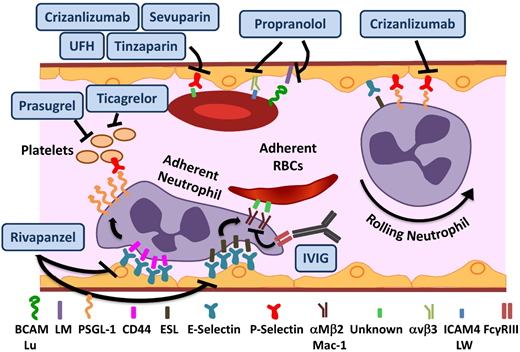 Figure 1. Novel agents targeting adhesion and coagulation in SCD. Numerous adhesive interactions among sRBCs, neutrophils, and endothelial cells contribute to sickle cell vasoocclusion. Activation of endothelial cells leads to the recruitment of neutrophils, which is initiated by rolling of neutrophils on endothelial selectins, followed by adhesion. Adherent neutrophils receive a secondary wave of signals transduced through E-selectin, leading to the activation of αMβ2 (Mac-1) integrin on the leading edge. Activated Mac-1 on adherent neutrophils mediates the capture of circulating sRBCs. In addition, sRBCs express multiple adhesion molecules that interact with ligands on endothelial cells or the subendothelial matrix either directly or via bridging molecules in the plasma. Rivipansel targets E-selectin predominantly, whereas crizanlizumab and sevuparin inhibit P-selectin–mediated adhesive interactions. IV immunoglobulin (IVIG) interferes with neutrophil-mediated sRBC capture. Propranol blocks various sRBC-endothelial interactions that are stimulated by β-adrenergic signaling, such as LW (ICAM4)-αVβ3 and BCAM/lu-laminin (LM). Unfractionated heparin (UFH) and tinzaparin, in addition to their anticoagulant effects, target P-selectin. ESL, E-selectin ligand; PSGL-1, P-selectin ligand 1. Adapted from Morrone et al48 with permission.