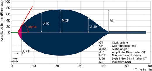 Figure 3. Rotational thromboelastometry (ROTEM) curve and parameters. Curve and parameters apply to the INTEM (mild intrinsic coagulation activation) and EXTEM (mild extrinsic coagulation activation) assays. Our algorithm uses the EXTEM assay, which is largely heparin insensitive and can, therefore, be used on a heparinized patient. EXTEM is also insensitive to extracorporeal‐induced platelet dysfunction. Prolonged EXTEM‐CT indicates reduced coagulation factor levels, and low‐amplitude EXTEM‐A10 indicates impaired clot firmness due to low fibrinogen levels or low platelet count. To differentiate between low fibrinogen levels and low platelet count, the algorithm uses the FIBTEM assay (mild extrinsic coagulation activation in the presence of a thrombocyte inhibitor to measure only the fibrin part of the clot). A low‐amplitude FIBTEM‐A10 indicates low fibrinogen levels. A normal FIBTEM‐A10 in the presence of a low‐amplitude EXTEM‐A10 indicates low platelet count.