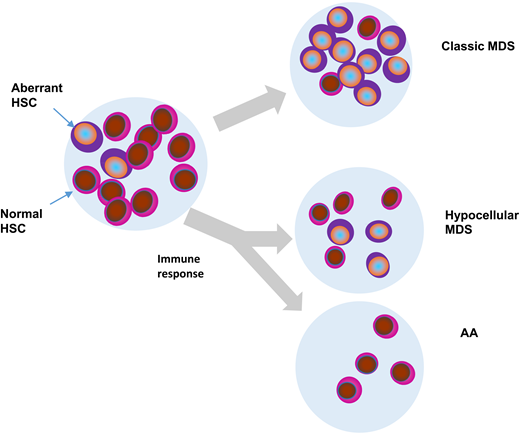 Hypothetical fates of aberrant myeloid clones in AA, typical MDS, and hypocellular MDS. HSC, hematopoietic stem cells.