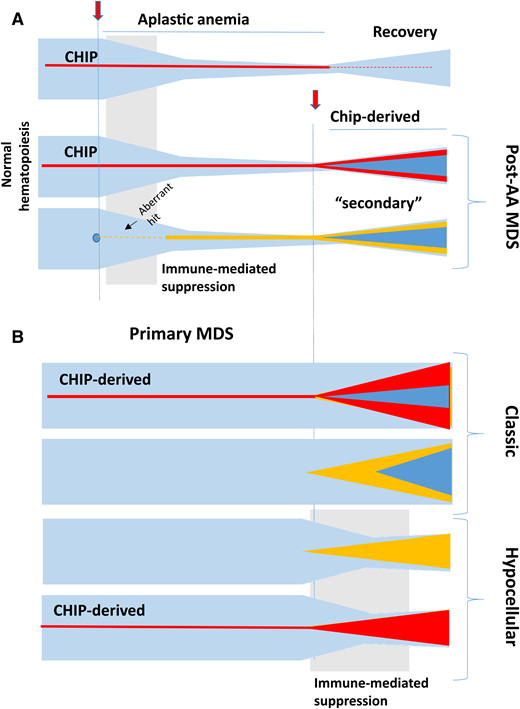 Clonal evolutionary chart of bone marrow failure syndromes over time for AA and primary MDS. Normal hematopoiesis would, if not influenced by a disease pathology, be expected to remain relatively stable with only a slow age-related decline. (A) CHIP, random or pathogenic aberrant myeloid clones, or idiopathic triggers can induce an immune reaction against the hematopoietic stem and progenitor cell (HSPC) compartment leading to AA with contraction of the HSCP pool. Transient or persistent benign clonality may result from CHIP. Either CHIP or another de novo aberrant clone may be an origin of clonal progression (eg, by the acquisition of additional genetic hits resulting in post-AA secondary MDS). (B) Similarly, primary MDS including its classic (hypercellular or normocellular) or atypical (hypocellular) forms can evolve from a slow-driving preexisting CHIP clone or an aberrant de novo somatic hit. Hypocellularity may be a result of immune attack stemming from a tumor surveillance reaction similar to idiopathic AA.