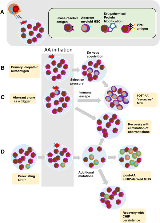 Pathogenetic theories of bone marrow failure as a result of interaction of the HSC compartment with the immune system. (A) Various triggers of a cytotoxic T-lymphocyte reaction in AA. (B) Immune attack against a hypothetical initiating event results in endogenous carcinogenesis and de novo acquisition of clonal events. Immune selection pressure can lead to further clonal evolution of secondary MDS after AA. (C) Theoretically, the aberrant clone itself may be a trigger leading to a similar pathogenic escape reaction and a similar outcome. It is also possible that either a nonspecific or an overshooting immune reaction leads to a contraction of the HSPC compartment as seen in AA or hypocellular MDS. Finally, ineffective tumor surveillance reaction fails to prevent clonal evolution analogous to classic or typical MDS. (D) Recent data demonstrate the presence of somatic mutant clones, consistent with CHIP, in patients with otherwise typical AA. In this scenario, immune response may further augment the oligoclonality by the removal of normal HSCs. Depending on the penetrance of somatic CHIP hits, they expand whereas normal cells are eliminated thus leading to hypocellular MDS. Alternatively, upon successful immunosuppression and recovery of the normal HSCs, the mutant clones are diluted out by expanded normal HSCs.