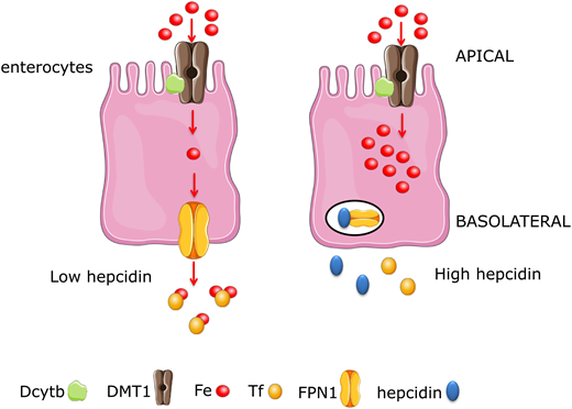 Regulating iron absorption dependent on apical import and basolateral export. At the duodenal enterocyte, where iron is absorbed, hepcidin functions as a negative regulator at the basolateral surface, where ferroportin exports iron from duodenal enterocytes into the circulation. Hepcidin-mediated changes in enterocyte iron content modulate HIF2α in enterocytes. HIF2α is stabilized when hepcidin is low during iron deficiency, resulting in increased transcription of DMT1 and Dcytb as well as ferroportin messenger RNA Together, stabilization of HIF2α in the gastrointestinal tract with suppression of hepcidin would provide the most potent stimulus for iron absorption. In high-hepcidin states, ferroportin internalization and degradation result in the accumulation of iron within the enterocyte, and it is excreted in the stool with the normal frequent turnover of the intestinal mucosa. Dcytb, duodenal cytochrome B; DMT1, divalent metal transporter 1; Fe, iron; FPN1, ferroportin 1; Tf, transferrin.