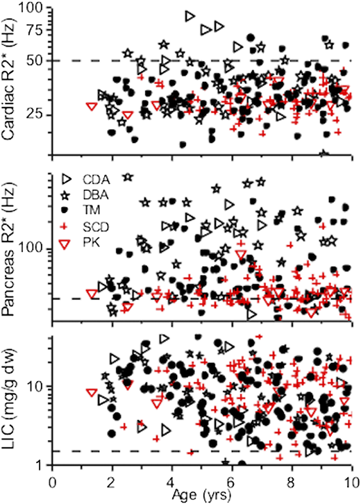 Iron loading in the patients with ineffective or no erythropoiesis (black) or effective erythropoiesis (red). All groups load the liver equally. The heart and pancreas, which primarily load when NTBI/LPI is high, have significantly less loading for disorders with effective erythropoiesis. The dashed line is the normal level. CDA, congenital dyserythropoietic anemia; DBA, Diamond Blackfan anemia; PK, pyruvate kinase deficiency; SCD, sickle cell anemia; TM, thalassemia major (from Coates8 and Berdoukas et al,13 with permission).