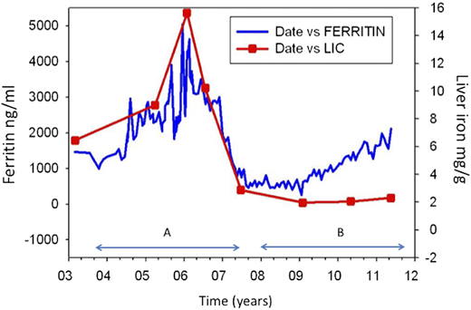 Time course of iron loading measured by MRI LIC and ferritin in a patient with thalassemia. Ferritin reflects the total iron well during period A but diverges significantly during period B. Ferritin values fluctuate significantly from point to point (from Taher et al,26 with permission).
