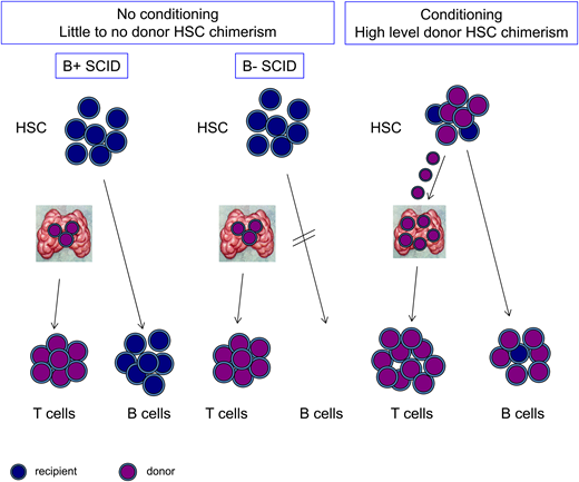 The effect of SCID subtype and use of conditioning on T- and B-cell chimerism. Patients with SCID who undergo HCT without conditioning have engraftment of donor-derived cells in the thymus, giving rise to donor-derived T cells (purple). HSCs and B cells, if present, remain largely of recipient origin (blue). With conditioning, donor HSCs can engraft, giving rise to donor-derived B cells, and also, they can continuously replenish progenitors in the thymus, resulting in robust and durable T-cell production.