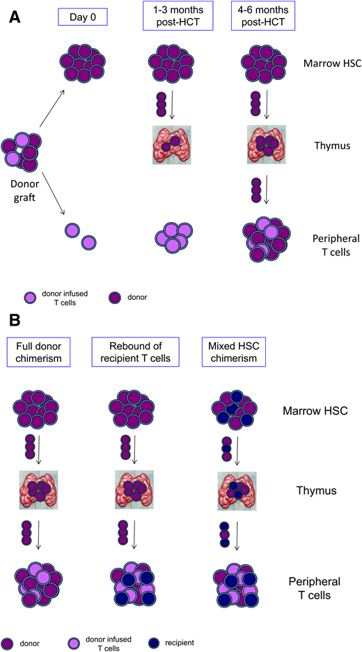 T-cell reconstitution and mixed chimerism after HCT. (A) The donor graft contains HSCs and progenitors that engraft in the marrow (purple) and mature T cells that have been tolerized to the donor and are adoptively transferred (lavender). Over the first 1 to 3 months post-HCT, transferred mature T cells proliferate extrathymically, and donor HSCs seed the thymus. Beginning at 4 to 6 months post-HCT, newly generated donor-derived naïve T cells emerge from the thymus and populate the periphery. (B) In states of full donor chimerism (left panel), marrow HSCs, thymocytes, and peripheral T cells are all donor derived (purple). Rebound of recipient T cells (blue) may occur despite full donor chimerism in HSCs and the development of donor T cells from the thymus (center panel). Mixed chimerism in T cells may also arise if there is mixed chimerism in HSCs, resulting in mixed chimerism in thymocytes and in naïve T cells emerging from the thymus (right panel).