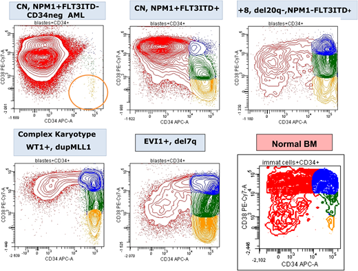 CD34/CD38 expression pattern of blasts from 5 diagnostic AML samples showing the variability in the frequency of the most immature leukemia cells (CD34+CD38−; orange) compared with normal BM. CN, normal cytogenetics. Figure by Adriana Plesa and Christophe Roumier, ALFA.