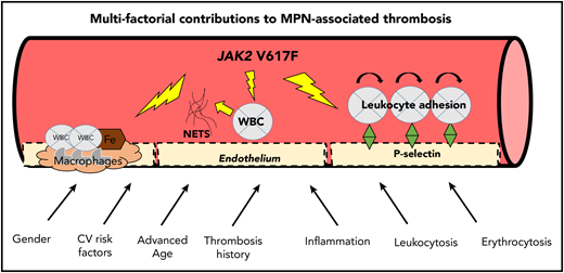 Multifactorial contributions to MPN-associated thrombosis. ASA, acetylsalicylic acid; WBC, white blood cells. Figure concept adapted in part from Setiadi et al.87