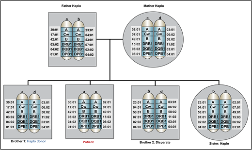 Family pedigree of the patient in the clinical case. An HLA-haploidentical donor has inherited one HLA haplotype in common with the recipient and is mismatched for anywhere between 0 and 5 HLA genes on the unshared haplotype. Biological parents and biological children always share an HLA haplotype with the recipient, unless a rare genetic rearrangement has occurred. In this pedigree analysis, the patient has 3 siblings, none of whom are HLA-matched, but 2 are partially matched related (haploidentical) donors, whereas 1 brother is disparate. Other potential HLA-haploidentical donors include half-siblings, aunts, uncles, nieces, nephews, cousins, or grandchildren.
