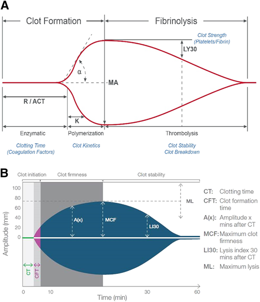 (A) Thromboelastography output demonstrating clot initiation, propagation, strength, and lysis. (B) Rotational thromboelastometry output demonstrating clot initiation, propagation, strength, and lysis.