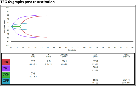 TEG 6s graphs postresuscitation.