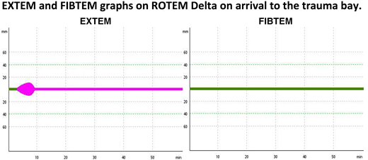 ROTEM Delta EXTEM and FIBTEM graphs on arrival at the trauma bay.