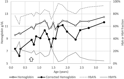 Case 4 depiction. A newborn with α-thalassemia major (−SEA/−SEA) was initially transfused with a goal of maintaining total Hb of 9 to 10 g/dL in the pretransfusion period (case 4). This was associated with effective functional Hb (total Hb − sum of HbH and Hb Bart) between 6 and 7 g/dL. Transfusion regimen was modified (arrow) to maintain HbA 9 to 10 g/dL, which was achieved with total Hb of ∼11 g/dL in the pretransfusion blood sample.