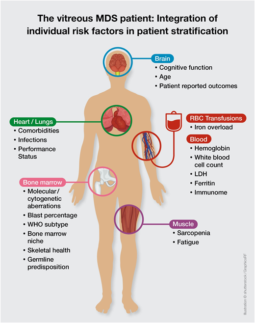 The vitreous MDS patient: integration of individual risk factors in patient stratification.