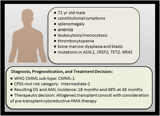 MDS/MPN overlap case study. Shown is the current clinical vignette with symptoms, laboratory results, diagnosis, and resulting prognostication. AML, acute myeloid leukemia; HMA, hypomethylating agent; OS, overall survival.