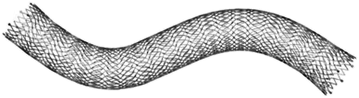 The Vici venous stent system.